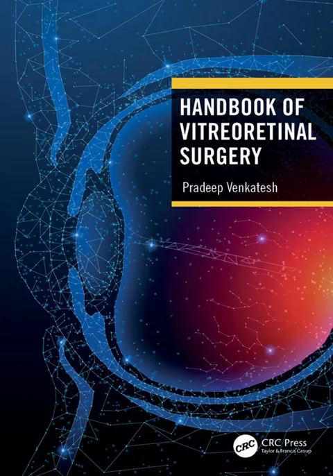 Handbook Of Vitreoretinal Surgery