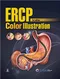 ERCP Color Illustration