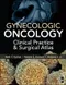 Gynecologic Oncology: Clinical Practice & Surgical Atlas