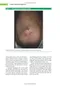Mayo Clinic Case Review for Pulmonary and Critical Care Boards (內附序號不可拆封)