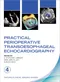 Practical Perioperative Transoesophageal Echocardiography