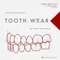 *Tooth Wear: Interceptive Treatment Approach with Minimally Invasive Protocols