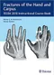 Fractures of the Hand and Carpus: FESSH 2018 Instructional Course Book