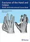 *Fractures of the Hand and Carpus: FESSH 2018 Instructional Course Book