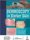 *Dermoscopy in Darker Skin