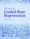 *30 Years of Guided Bone Regeneration