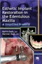 Esthetic Implant Restoration in the Edentulous Maxilla: A Simplified Protocol