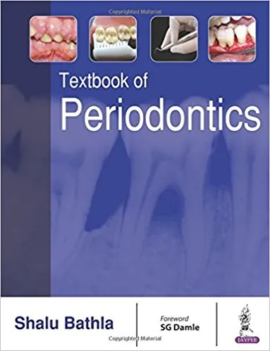 Textbook of Periodontics