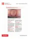 Fitzpatrick's Color Atlas and Synopsis of Clinical Dermatology