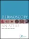 Dermoscopy: An Atlas