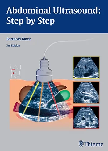 語学・辞書・学習参考書 TEXTBOOK OF ABDOMINAL ULTRASOUND 語学・辞書・学習参考書 TEXTBOOK OF ABDOMINAL ULTRASOUND 語学