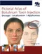 Pictorial Atlas of Botulinum Toxin Injection: Dosage, Localization, Application