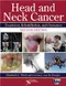 *Head and Neck Cancer: Treatment, Rehabilitation, and Outcomes with CD-ROM