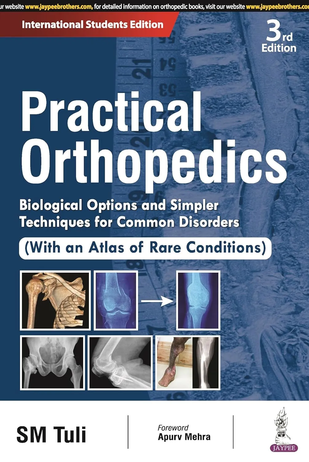 Practical Orthopedics: Biological Options and Simpler