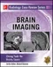 *Radiology Case Review Series: Brain Imaging