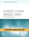 Chest X-Ray Made Easy (IE)
