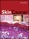 (舊版特價-恕不退換))Skin Cancer
