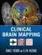 Clinical Brain Mapping