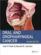 Oral and Oropharyngeal Cancer