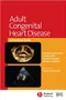 Adult Congenital Heart Disease: A Practical Guide