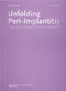 Unfolding Peri-Implantitis: Diagnosis,Prevention,Management