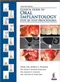 Clinical Guide to Oral Implantology: Step by Step Procedures