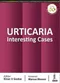 URTICARIA: Interesting Cases