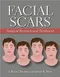Facial Scars: Surgical Revision and Treatment