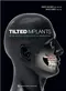 *Tilted Implants: Implant-Prosthetic Rehabilitation of the Atrophic Patient