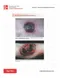 Fitzpatrick's Color Atlas and Synopsis of Clinical Dermatology