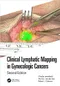 Clinical Lymphatic Mapping in Gynecologic Cancers