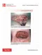 Fitzpatrick's Color Atlas and Synopsis of Clinical Dermatology