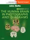 (舊版)The Human Brain in Photographs and Diagrams: With Student Consult Online Access