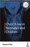 Chest X-ray in Neonates and Children