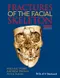 Fractures of the Facial Skeleton
