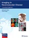 *Imaging in Neurovascular Disease: A Case-Based Approach