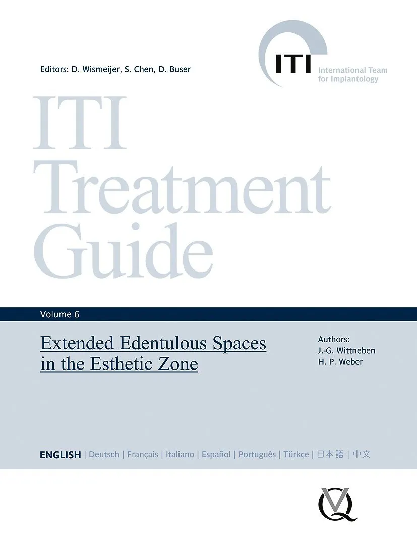 ITI Treatment Guide Vol.6: Extended Edentulous Spaces in the