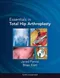Essentials in Total Hip Arthroplasty