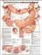 Understanding Colorectal Cancer Anatomical Chart Paper Unmounted