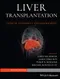 Liver Transplantation: Clinical Assessment and Management