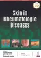 Skin in Rheumatologic Diseases