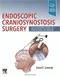 (特價-書角略有小凹-可接受再購買-不可退貨)Endoscopic Craniosynostosis Surgery: An Illustrated Guide to Endoscopic Techniques