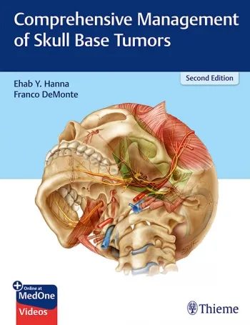 skull anatomy 健康・医学 the of base Surgical