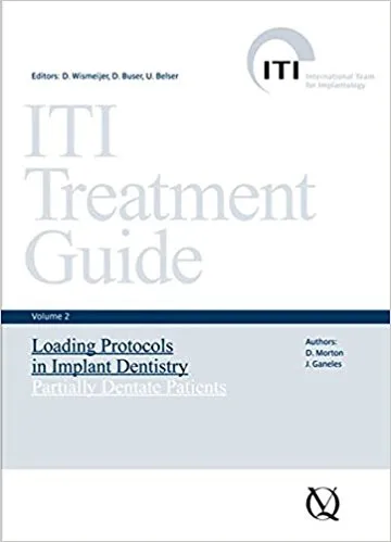 ITI Treatment Guide2 インプラント歯学における荷重プロトコー ITI Treatment Guide Volume 2 インプラント歯学における荷重
