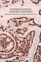Understanding Cancer Therapies