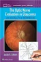 *The Optic Nerve Evaluation in Glaucoma: An Interactive Workbook