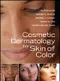 Cosmetic Dermatology for Skin of Color