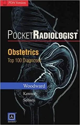 Pocket Radiologist: Obstetrics Top 100 Diagnosis