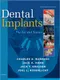 Dental Implants: The Art and Science