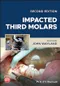 Impacted Third Molars